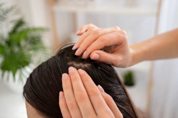 close-up-hands-treating-dandruff-1080x675